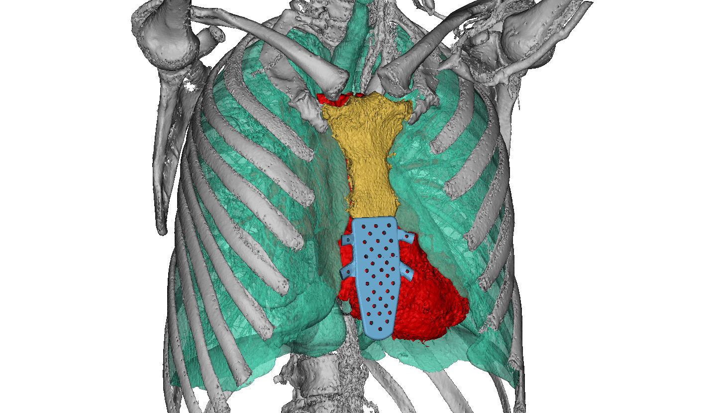 Thoracic reconstruction anatomical model